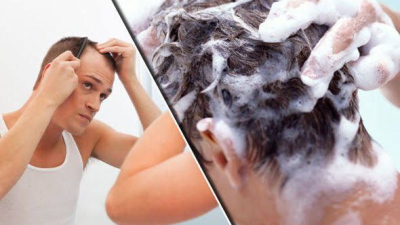 وېښتانو توېدل