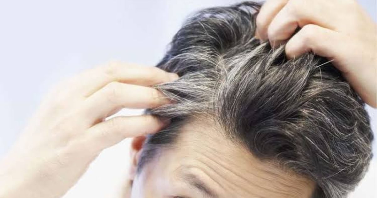 په ځوانۍ کې د ويښتانو سپينېدل او درملنه