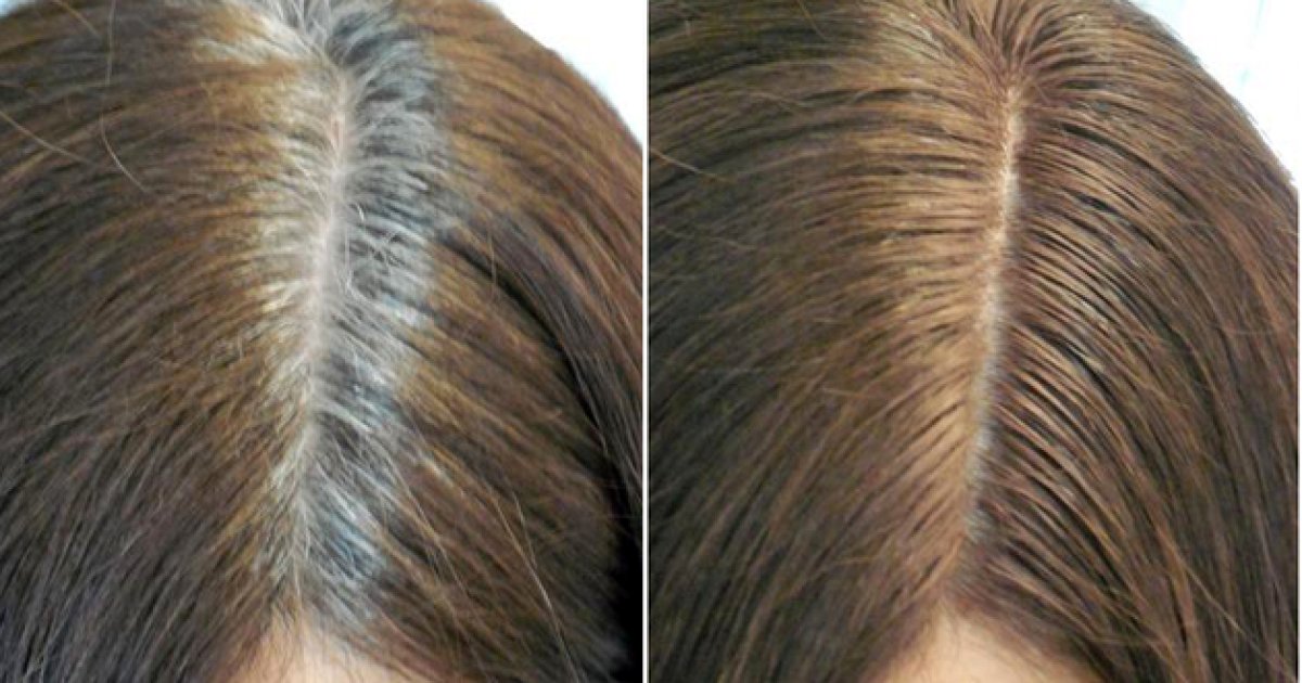 له وخت څخه مخکي مو ويښتان ولي سپينږي درملنه يې څه ده؟